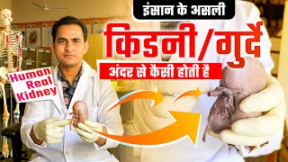 HUMAN REAL KIDNEY amp KIDNEY STONES  किडनीगुर्दे अंदर से कैसी होती है और इसमें पथरी कहाँ बनती है [upl. by Nelyt]