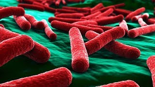 Everything to know about E coli amid outbreak [upl. by Lazare]