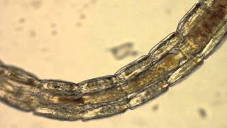 Chironomidae  A Midge Larvae [upl. by Neila276]