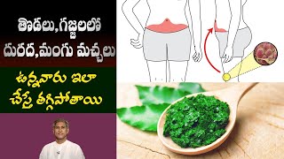 Home Remedy for Skin Diseases  Reduces Eczema and Dermatitis  Rashes  Dr Manthenas Health Tips [upl. by Ardeth]