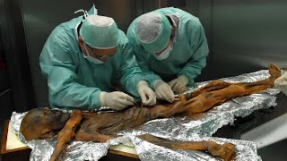 Scientists Finally Study Ötzi the Icemans Gut And Discover New Fungus [upl. by Ateiluj]