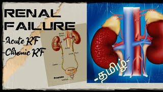 Renal failure தமிழ் Acute Renal failure Chronic Renal failure Kidney failure Tamil MEDI TAMIL [upl. by Adnam]