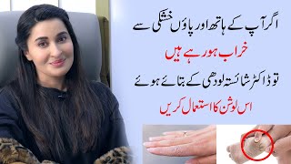 Best Solution for dry skin of hand and feet by Dr Shaista Lodhi  Ladies Talk [upl. by Elgna]