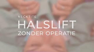 NeckTite behandeling  halslift zonder operatie  ReSculpt Clinic [upl. by Nee208]