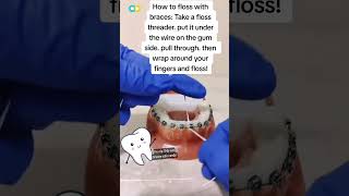 Master the CShaped Flossing Technique with These Dental Tips [upl. by Camus646]