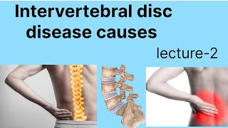 Intervertebral disc disease causes Intervertebral disc disease [upl. by Nenney391]