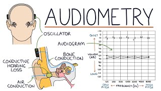 Understanding Audiometry and Audiograms [upl. by Anigue]