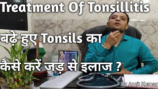 Treatment Of Tonsillitis  बढ़े हुए Tonsils का कैसे करें जड़ से इलाज Tonsils का इलाज। [upl. by Gerfen]