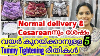 Tummy Tuck Methods to Reduce Belly after Normal Delivery amp Cesarean Pregnancy Lactation Series32 [upl. by Accber186]