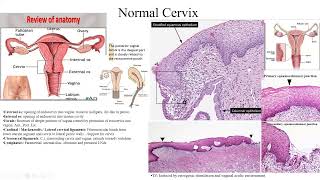 Pathology Made EasySystemic Pathology 10 Female genital system Diseases3 [upl. by Lleihsad]