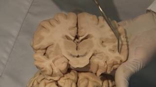 Cortical Localization Neuroanatomy Video Lab  Brain Dissections [upl. by Stalker187]