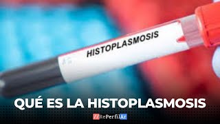 Qué es la histoplasmosis [upl. by Nobell]