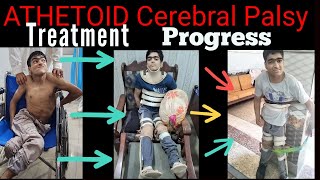 Athetoid Cerebral Palsy During treatment progress  Adult Cerebral Palsy Patient [upl. by Hgielrebmik]