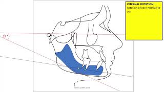 mandibular rotation [upl. by Munster]