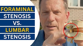 Foraminal vs Lumbar Stenosis Breakthrough Treatment Revealed  Dr John Zielonka [upl. by Whitford]