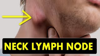 How to explore lymph nodes on ENT [upl. by Julia]