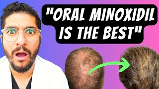 99 Miss This NEW Hair Loss Treatment – Dermatologist Explains [upl. by Nilam]