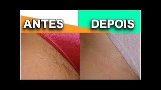 Depilação com Cera Caseira Regiao Intima virilha [upl. by Felisha921]