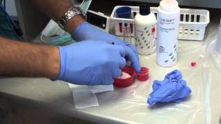 Denture Soft Reline Part 1 [upl. by Zoa]