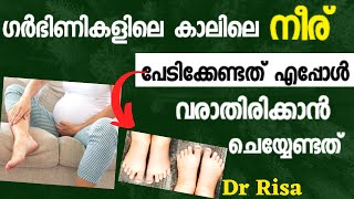 Swelling of Leg During PregnancyPregnancy Healthy Issues [upl. by Tuorah293]