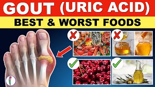 Uric acid Foods to Avoid  Gout Diet Meal Plan  Gout  Uric acid  Best amp Worst Foods [upl. by Ycniuqed510]