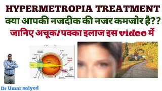 HYPERMETROPIA TREATMENT नजदीक की नजर कमजोर होना [upl. by Doner]