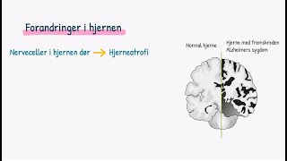 Nervesystemet Demens [upl. by Hueston]