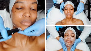 My Deluxe HydraFacial Treatment  Vedette Beauty amp Skincare  Combination Skin [upl. by Evonne]