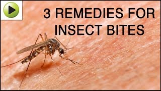 Insect Bites  Natural Ayurvedic Home Remedies [upl. by Aserehs]