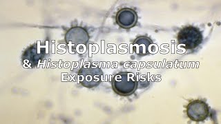 Histoplasmosis and Histoplasma capsulatum Exposure Risks [upl. by Aurie]