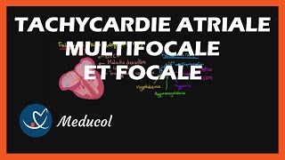 Tachycardie Atriale Multifocale et Tachycardie Atriale Focale Physiopathologie symptômes et ECG [upl. by Aimahs]