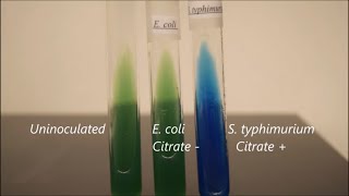 IMViC Timelapse Indole MRVP and Citrate [upl. by Giacopo787]