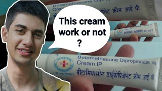 Betamethasone Dipropionate Cream  Review of Betamethasone Dipropionate [upl. by Eirollam]