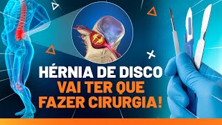 COMO FICAR LIVRE DA HÉRNIA DE DISCO SEM PASSAR POR CIRURGIA  Fisioprev [upl. by Kessia]