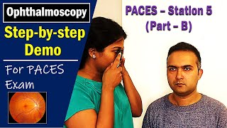 PACES UK Station 5 OphthalmoscopyFundus Exam Stepbystep Howto Guide [upl. by Morell154]