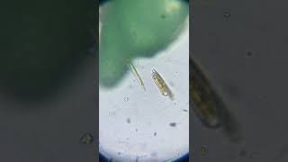 矽藻打群架 Gang war of Diatoms [upl. by Center]