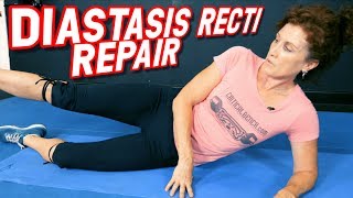 Top 5 Exercises to REPAIR Diastasis Recti [upl. by Ennayelsel598]