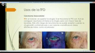 PRINCIPIOS DE TERAPIA FOTODINAMICAPRINCIPLES OF PHOTODYNAMIC THERAPY [upl. by Einna]