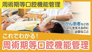 20これでわかる！ 周術期等口腔機能管理 [upl. by Baun]