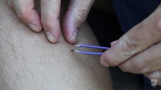 Mayo Clinic Minute Tips to best remove ticks [upl. by Sims543]