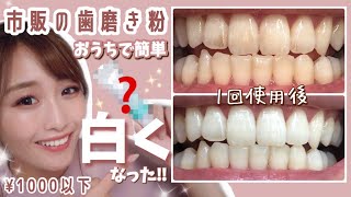 【驚愕‼︎】1回の歯磨きで歯が白く！ステイン着色汚れが気になる人必見！お家でお手軽【ホームホワイトニングケア】 [upl. by Hines]