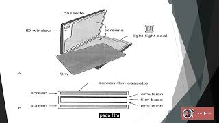 Radiofotografi  Intensifying Screen IS [upl. by Norma]