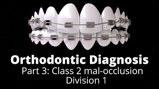 Grand Rounds Chronic Migraine Pt 3 [upl. by Eenat855]