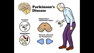 Parkinsons amp Levodopa [upl. by Norrahc]