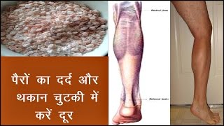 करेंगे ये उपाय तो छूमंतर हो जायेगा पैरों का दर्द और थकानHeel pain pairon ka dard [upl. by Ardien]