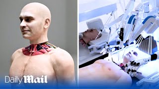 Worlds FIRST head transplant system has been unveiled [upl. by Norvan]