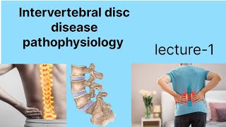 Inter vertebral disc disease IVDD hindi main IVDD pathophysiology [upl. by Julian131]