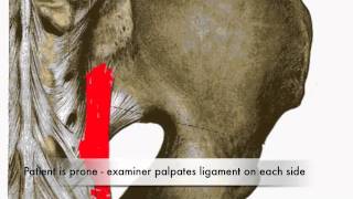 Provocation of Long Dorsal Sacroiliac Ligament Test CR [upl. by Aowda]