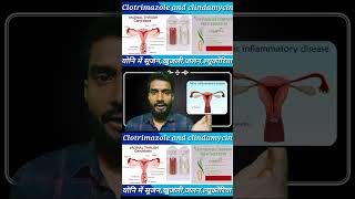 clotrimazole and clindamycin  cansoftcl  candidcl  vaginalinfection  shortvideo  viral [upl. by Inot]