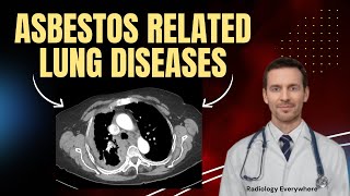 7 Dangerous Lung Conditions Caused by Asbestos Explained in 3 Minutes [upl. by Garlanda]